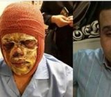 سهم جانبازی ۸۵ درصدی پلیس جوان شفتی در راه مبارزه با مواد مخدر